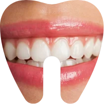 Cosmetică dentară: albirea dinților