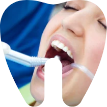 Profilaxie dentară: detartraj și periaj profesional, airflow, sigilări dentare