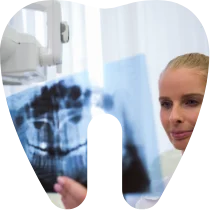 Tratamente endodontice: tratamentul canalelor radiculare